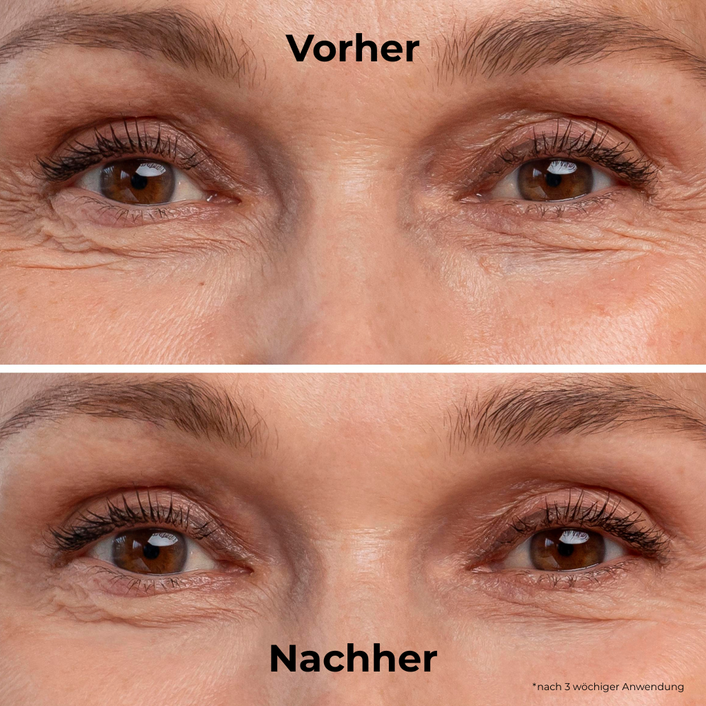 EVAIA Hydro Eye Patches – 60 Stück